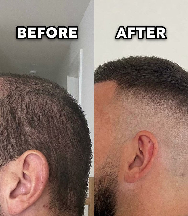 Joe's hairline before and after, his own footage